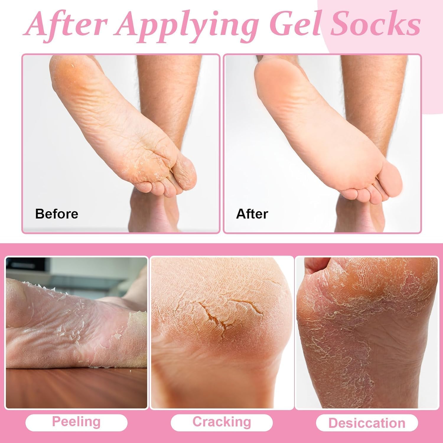 Cracked Heal Repair Moisturizing Silicone Gel Socks