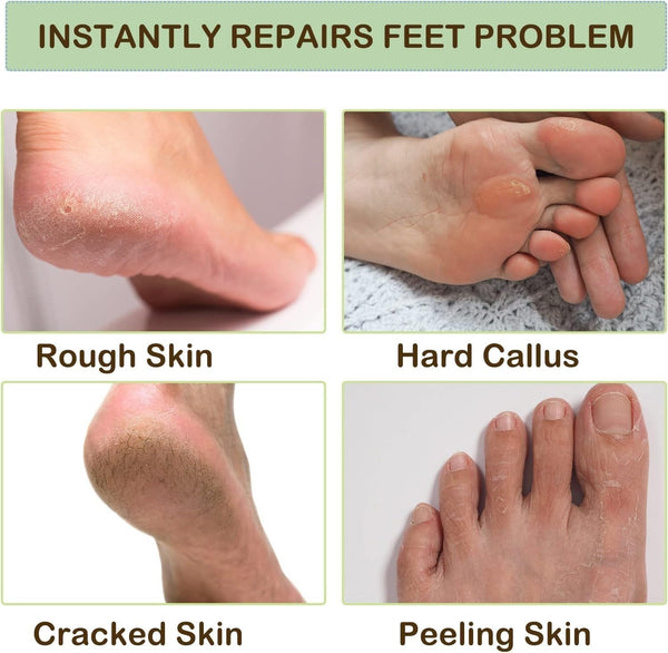 Cracked Heal Repair Moisturizing Silicone Gel Socks